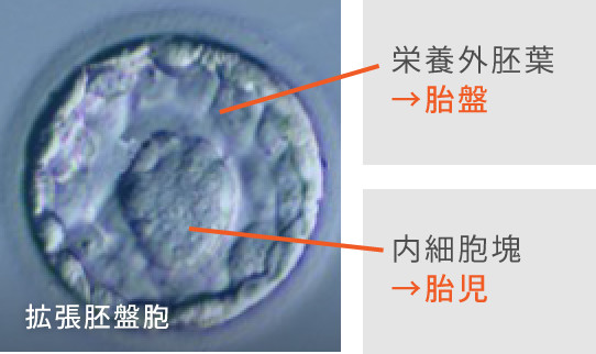 胚盤胞の形態